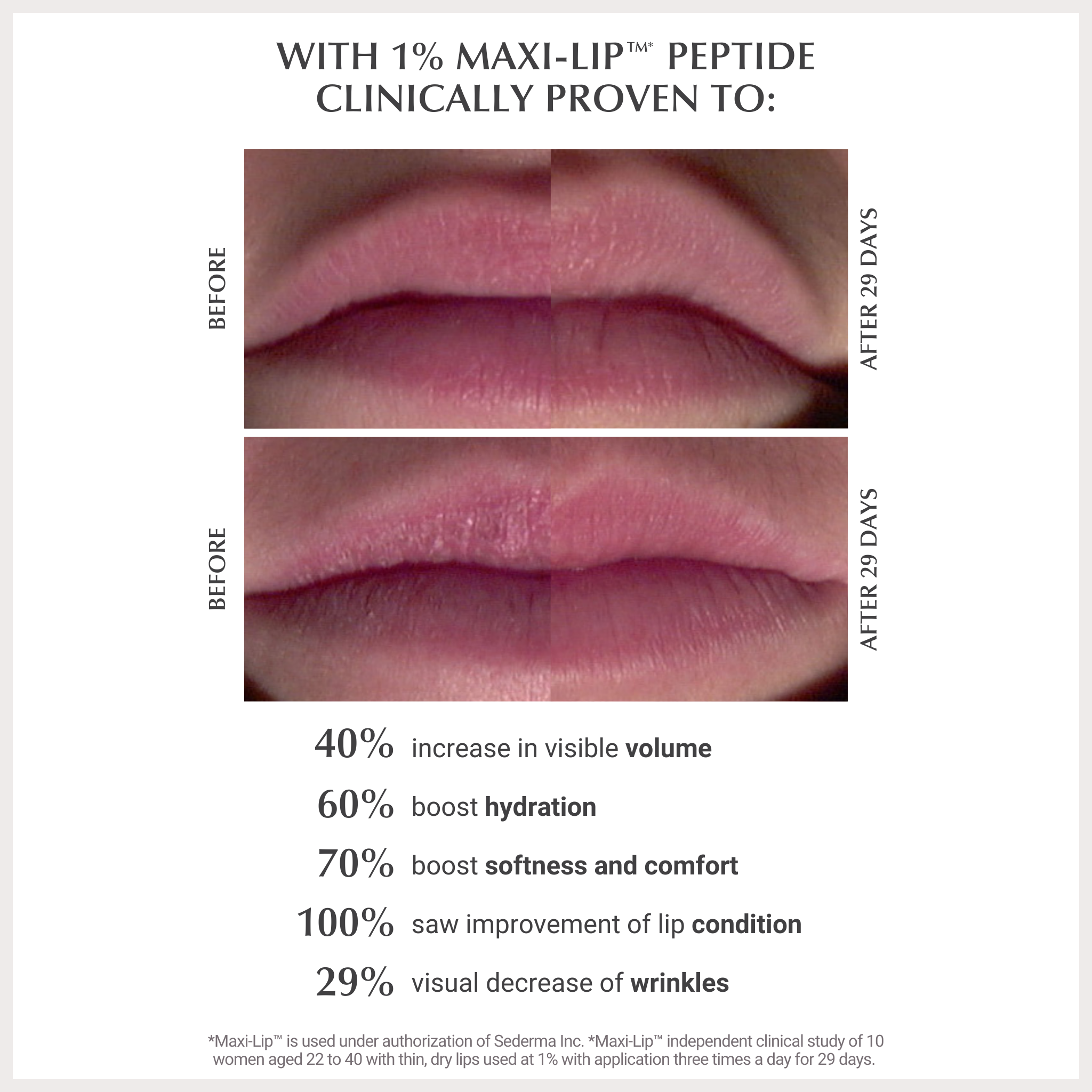 BUTTER BALM - PINK LOLLIPOP - TB3